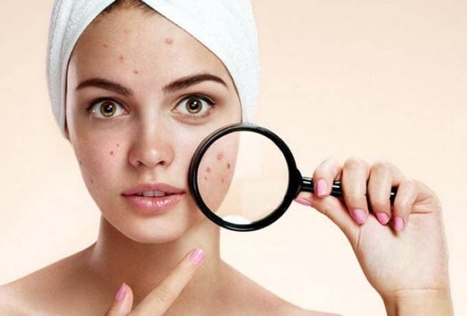 UGRILARNI UY SHAROITIDA YO’QOTISH, DORLIAR BILAN KETKAZISH USULLARI, DAVOLASH YO’LLARI