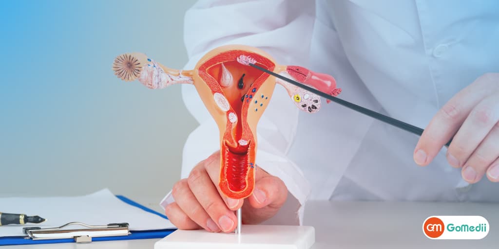 Hindistonda Fallop naychasini blokirovka qilishning eng yaxshi davolash usulini oling