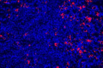 Yallig’lanishga qarshi gen buyrak kasalliklarini davolashda kalit bo’lishi mumkin: Healthcare Asia Daily News