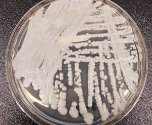 O’limga olib keladigan qo’ziqorin: o’sib borayotgan global salomatlik tahdidi – iqlim o’zgarishi aybdormi?  – Healthcare Asia Daily News |  Sog’liqni saqlash va tibbiyot sanoati, tibbiyot texnologiyalari, sog’liqni saqlash biznesi va ilmiy-tadqiqot ishlari, sog’liqni saqlash tadbirlari bo’yicha Osiyoning yetakchi yangiliklari va axborot manbai.  2010 yildan beri onlayn: Healthcare Asia Daily News