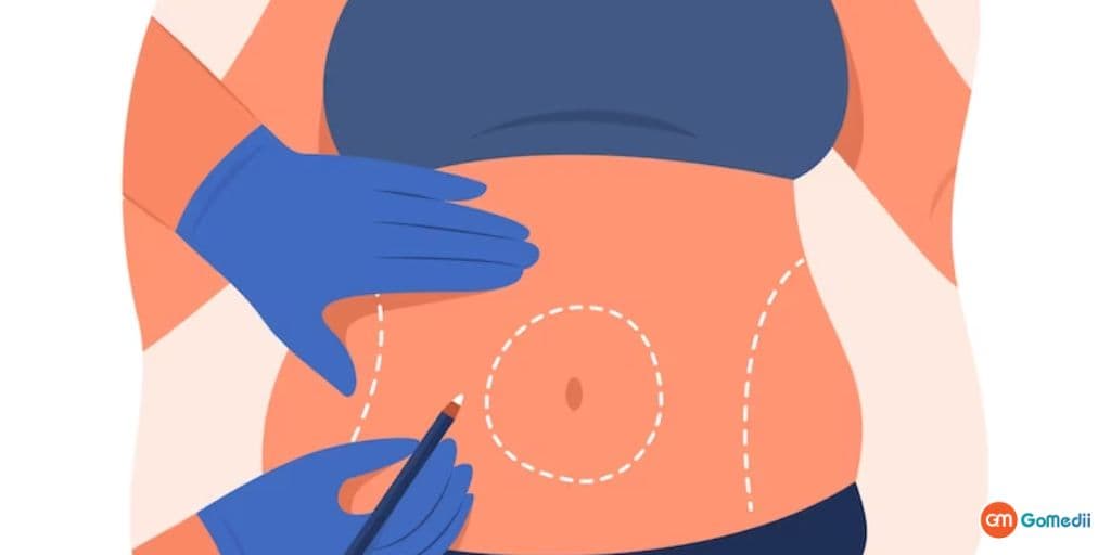 GoMedii yordamida Hindistonda gastrik bypass jarrohligini oling