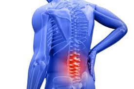 Umurtqa disk churrasi