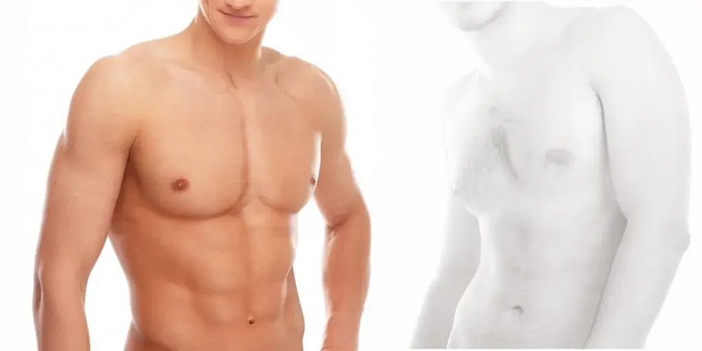 Ginekomastiya — sababi, alomatlari, tashxislash va davolash