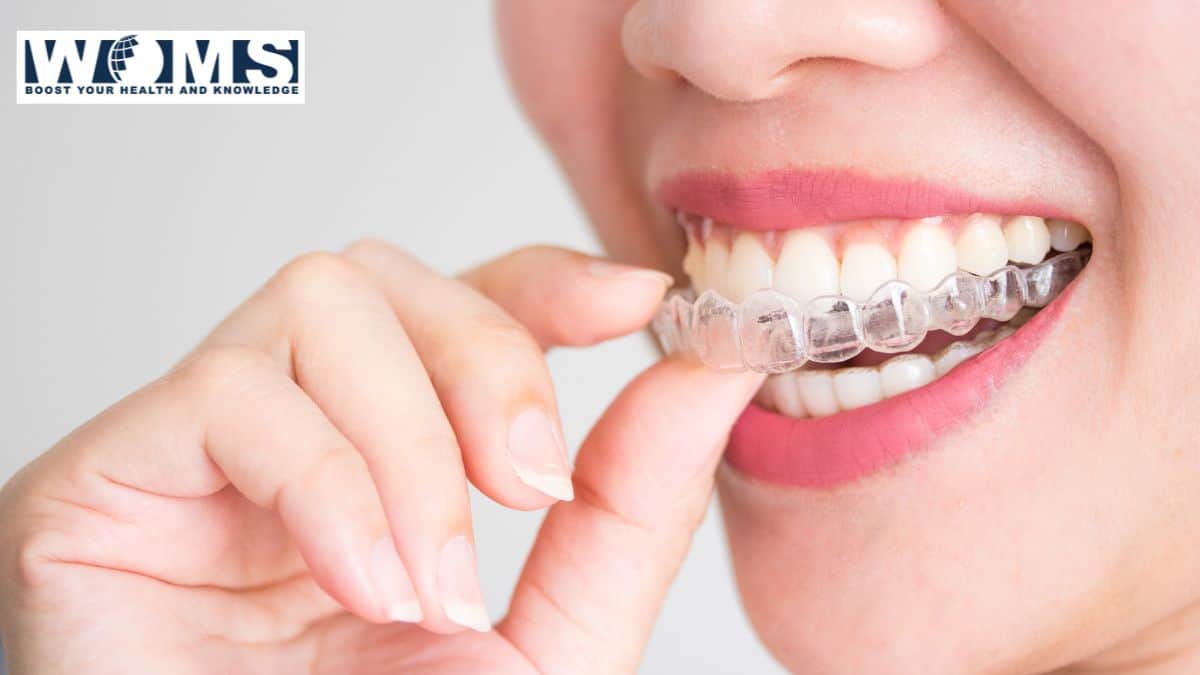 Invisalign: Chiroyli tabassum uchun aniq tanlov