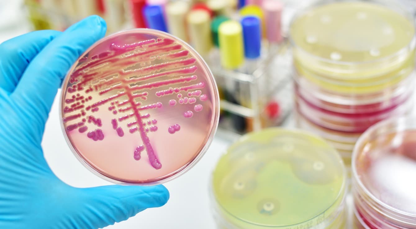 Omon qolgan sepsis: hayot va martabani o’zgartiradigan tajriba